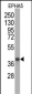 EPHA5 Antibody